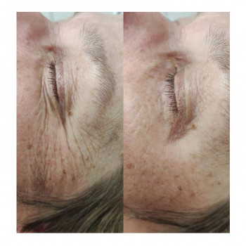 Людмила Чайка, Київ Фото - 9