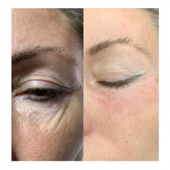 Людмила Чайка, Київ Фото - 8