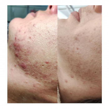 Людмила Чайка, Київ Фото - 7