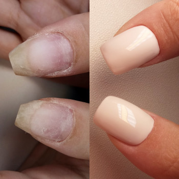 Натали Струналь, Одесса Фото - 5