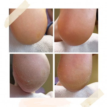 Натали Струналь, Одесса Фото - 13