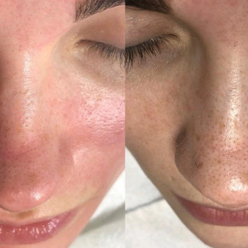 Татьяна Рогачевська, Херсон Фото - 11