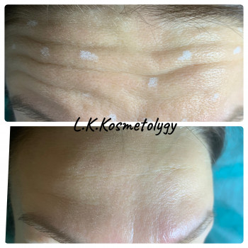 Лариса Петрівна, Луцьк Фото - 61