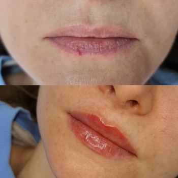 Естественный объем