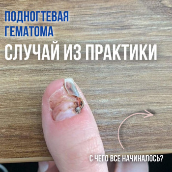 маникюр