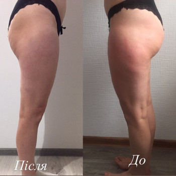 Светлана Якимчук, Черновцы Фото - 4