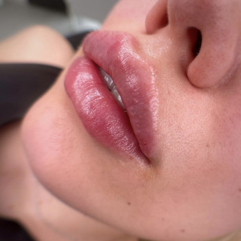 Увеличение губ
                    Мастер перманентного макияжа Юлия Киев