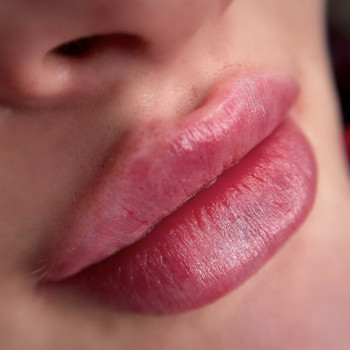 Увеличение губ
                    Мастер перманентного макияжа Юлия Киев