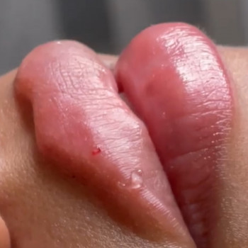 Увеличение губ
                    Мастер перманентного макияжа Юлия Киев