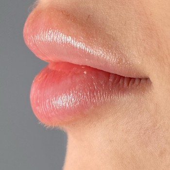 Іріс, Тернополь Фото - 53