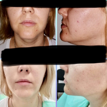 Tiana beauty, Киев Фото - 9