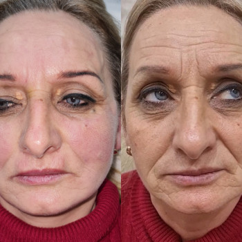 Ирина Булгар, Одесса Фото - 63