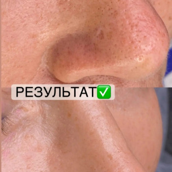 Виктория Овчар, Херсон Фото - 25