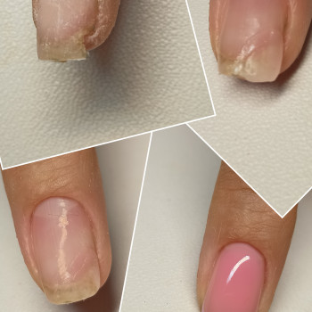 Наращивание ногтей
                    Майстер манікюру Натали Одеса