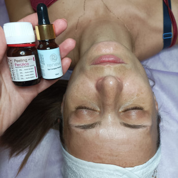 Феруловий пілінг