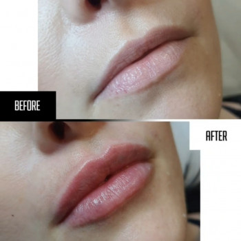 Ліна Гетьман, Тернополь Фото - 8