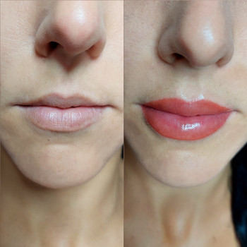 Elena Zilinskaya, Одесса Фото - 10