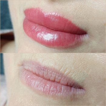 Elena Zilinskaya, Одесса Фото - 11