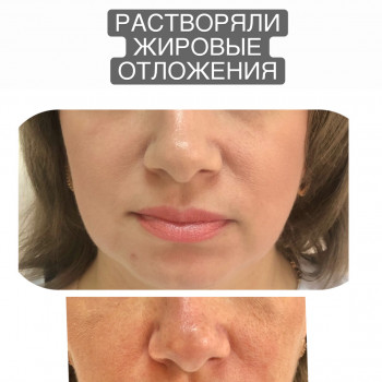 Ангелина Штирбу, Кривой Рог Фото - 5