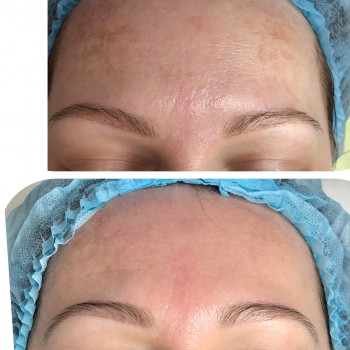 Ангелина Штирбу, Кривой Рог Фото - 6