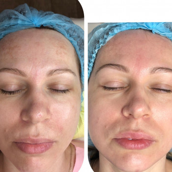 Ангелина Штирбу, Кривой Рог Фото - 7