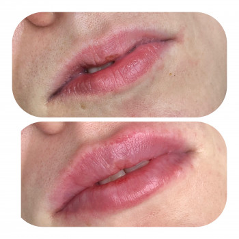 Ангелина Штирбу, Кривой Рог Фото - 8