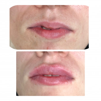 Ангелина Штирбу, Кривой Рог Фото - 9