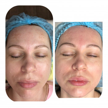 Ангелина Штирбу, Кривой Рог Фото - 10