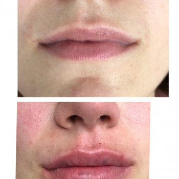 Ангелина Штирбу, Кривой Рог Фото - 11