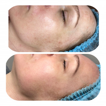 Ангелина Штирбу, Кривой Рог Фото - 12