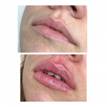 Ангелина Штирбу, Кривой Рог Фото - 13