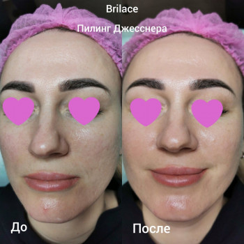 Ангелина Штирбу, Кривой Рог Фото - 15