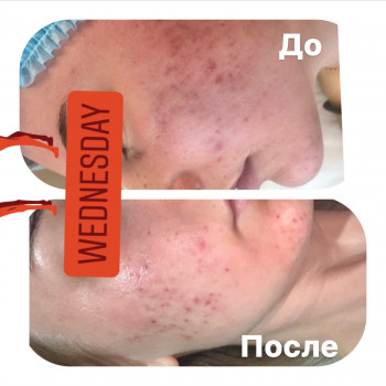 Ангелина Штирбу, Кривой Рог Фото - 16