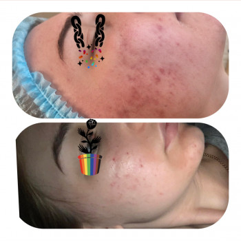 Ангелина Штирбу, Кривой Рог Фото - 17