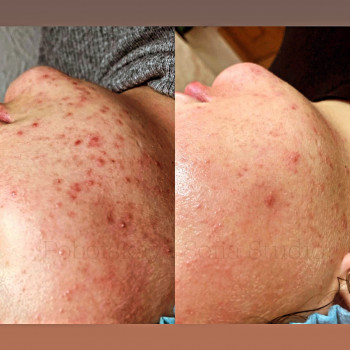 Ангелина Штирбу, Кривой Рог Фото - 26