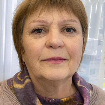 Загоєний перманент брів, одна процедура