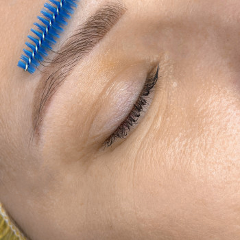 Загоєнний перманент брів, одна процедура