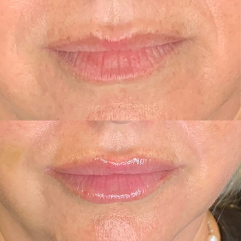 Фото из портфолио косметолога Анастасия (Одесса)