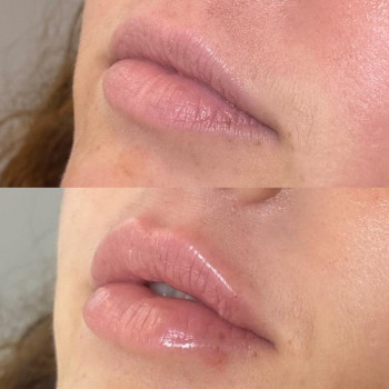 Фото из портфолио косметолога Анастасия (Одесса)