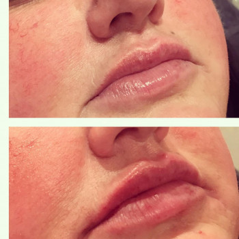 Фото из портфолио косметолога Анастасия (Одесса)