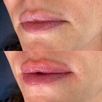 Фото из портфолио косметолога Анастасия (Одесса)