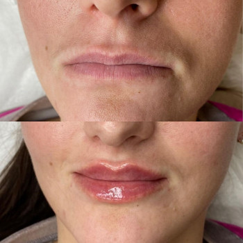 Фото из портфолио косметолога Анастасия (Одесса)