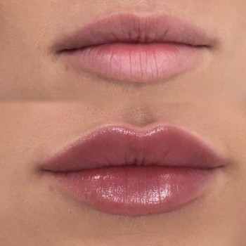 Фото из портфолио косметолога Анастасия (Одесса)