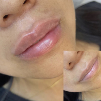 Фото из портфолио косметолога Анастасия (Одесса)