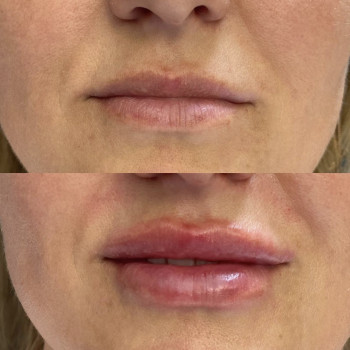 Фото из портфолио косметолога Анастасия (Одесса)