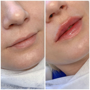 Фото из портфолио косметолога Анастасия (Одесса)