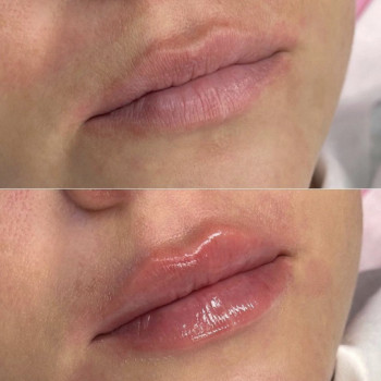 Фото из портфолио косметолога Анастасия (Одесса)