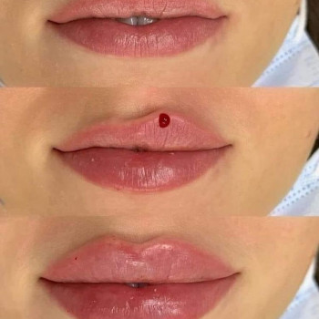 Фото из портфолио косметолога Анастасия (Одесса)