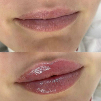 Фото из портфолио косметолога Анастасия (Одесса)