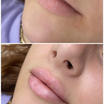 Фото из портфолио косметолога Анастасия (Одесса)